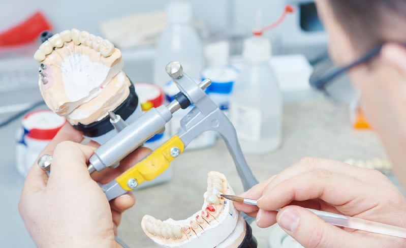 imagen promocional del curso Técnico Superior en Prótesis Dentales